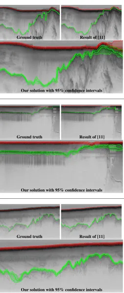 Table 1. Evaluation of our method on the test set. Error ismeasured in terms of absolute column-wise difference com-pared to ground truth, summarized with average mean devia-tion and median mean deviation across images, in pixels.