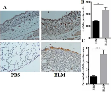 Figure  1.  Bleomycin  increases  the  expression  of  α-SMA  in  skin  and  lung  tissues  of  bleomycin-induced  systemic  sclerosis  mouse model