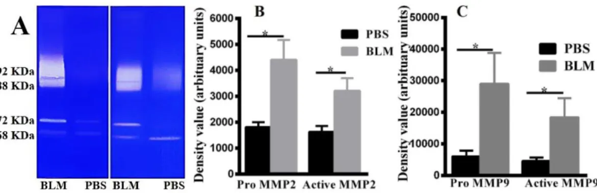 Figure 3. Gelatinases  increase in skin  tissues of  bleomycin-induced  systemic sclerosis mouse  model