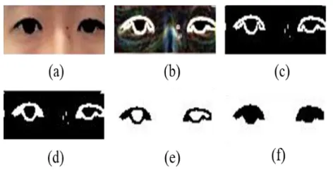 Fig -5:. Eye capture process: (a) Eye detection of face skin color detection image (b) Eye soble edge detection image (c) Eye binarization image (d) Closing operation and 