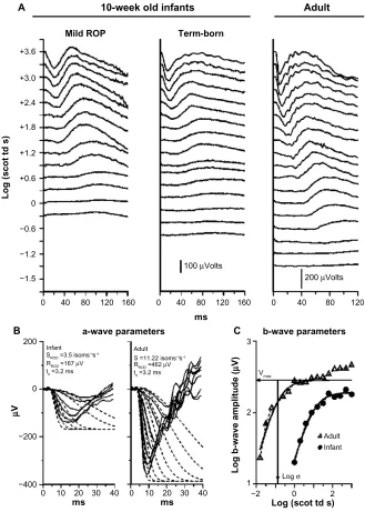 Figure 2 Sample rod-mediated ERG responses to full-field stimuli.normally developing eye, S(triangles)