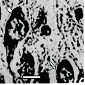 Figure 3. Light microscopy of cell types in the CA3: Large pyramidal cell (arrowhead) and small pyramidal cell (arrow)