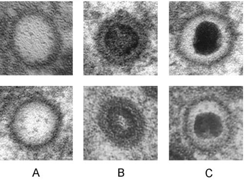 Figure 1Herpesvirus nucleocapsids at defined stages of maturationHerpesvirus nucleocapsids at defined stages of maturation