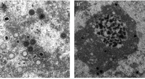 Figure 2Typical transmission electron micrograph images of developing herpesvirus whose analysis is desirable (A and B)Typical transmission electron micrograph images of developing herpesvirus whose analysis is desirable (A and B)
