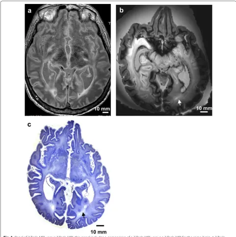 Fig. 1 Panel of 3 Tesla MRI versus 7 Tesla MRI: this panel includes a comparison of a 7 Tesla MRI versus a 3 Tesla MRI for the same brain