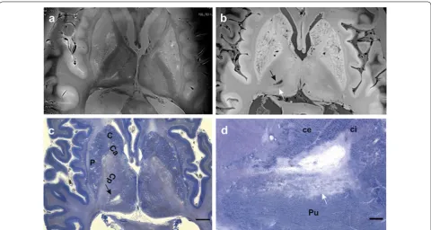 Fig. 3 fixated brain. 3D GRE TR 12 s, TE 8 s, 0.3 mm in plane resolution and 0.6 mm slice thickness