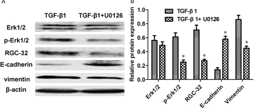Figure 3. (A) Representative images of western blot and (B) relative protein quantifications displayed the effects of TGF-β1 and TGF-β1 + U0126 on the levels of Erk, p-Erk, RGC-32, E-cadherin and Vimentin proteins after the BxPC-3 cells was incubated with 