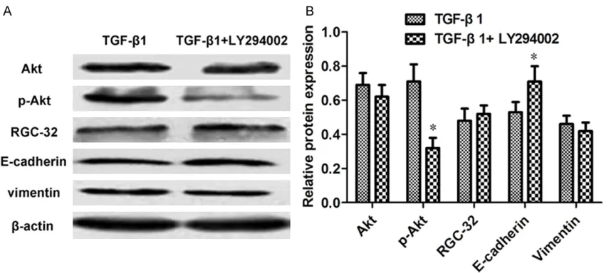 Figure 4. The analysis of proteins related with p38-MAPK pathway. (A) Representative images of western blot and (B) relative protein quantifications displayed the effects of TGF-β1 and TGF-β1 + SB203580 on the levels of p38, p-p38, RGC-32, E-cadherin and V