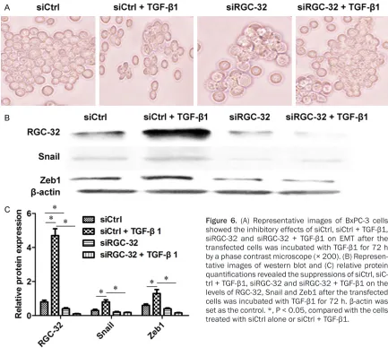 Figure 6. (A) Representative images of BxPC-3 cells showed the inhibitory effects of siCtrl, siCtrl + TGF-β1, siRGC-32 and siRGC-32 + TGF-β1 on EMT after the transfected cells was incubated with TGF-β1 for 72 h by a phase contrast microscope (× 200)
