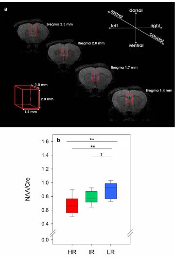 Fig. 4: Localization and volume of region of interest for prefrontalcortex spectroscopic was statistically analyzed using the KWH-test followed by reactivity