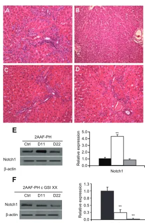 Figure 2 Real-time PcR analysis of notch pathway genes. at day 11 post-PH in livers isolated from animals on the 2AAF-PH protocol as compared with controls
