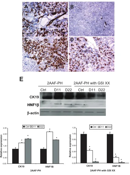 Figure 3 Analysis of oval cell surface marker expression upon notch inhibition. A–D) immunohistochemical analysis of OV-6 expression during 2AAF-PH alone (A and B) and in combination with gsi XX treatment (C and D)