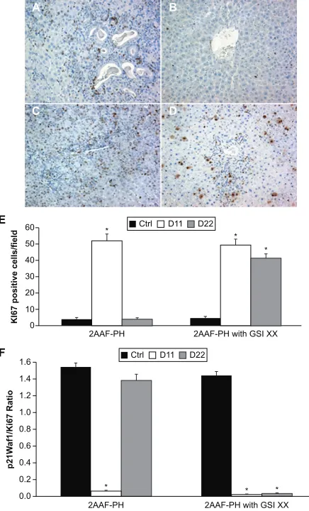 Figure 4 Aberrant AFP expression profiles in the absence of Notch. treatment groups. increase in AFP expression at day 11 post-PH (22 post-PH (B)