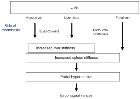 Table 7 Liver stiffness and portal hypertension by pre-and postsinusoidal thrombosis