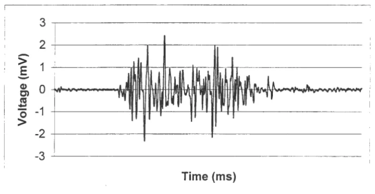 Figure 4.1. Typical EMG signal, the sum total of a muscle's electrical activity. 