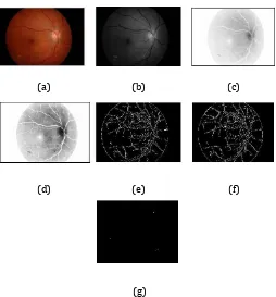 Fig.4. Processes in Detection of Microaneurysms (a) Original Fundus Image (b) Green Channel Image (c) Reversed Image (d) CLAHE Image (e) Edge Detected Image (f) Holes Filled Image (g) Extracted Microaneurysms  