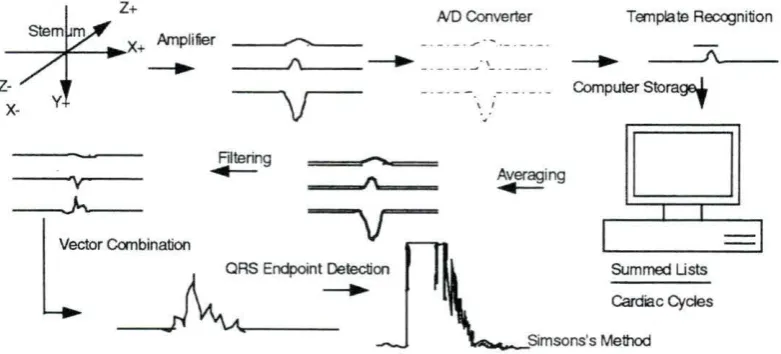 Figure 2.2: The Signal Average ECG System 