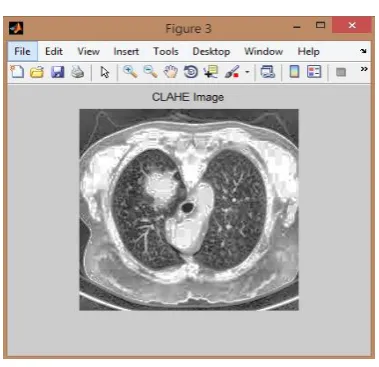 Fig 3: SVM Classifier  