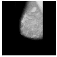 Figure -2: The image after the application of median filter  