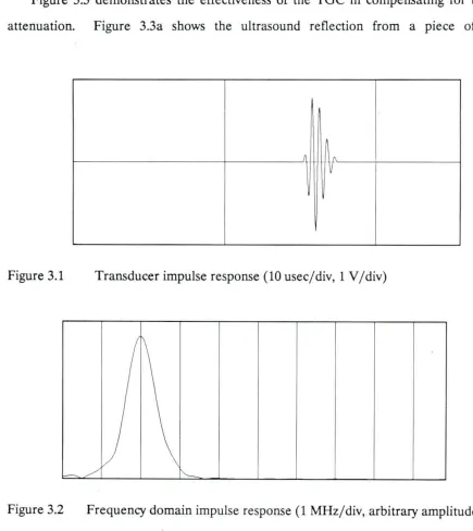 Figure 3.3 demonstrates the effectiveness of the TGC in compensating for tissue 