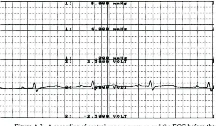 Figure A2. A recording of aortic and ventricular pressure before the heart 