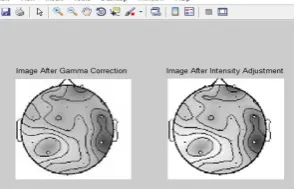 Fig - 4: Input image of neural patterns 