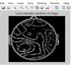Fig - 6: Local standard deviation of image 