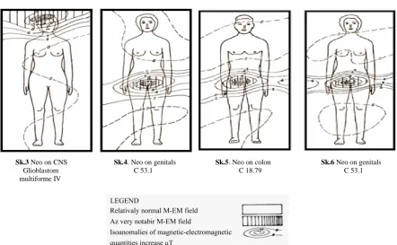 Figure 1. Relaps with dimension as shown in CT record.                               