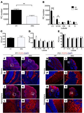 Figure 3. Deletion of Chd7length of the PC layer (mm) (test. (sections through the vermis (left