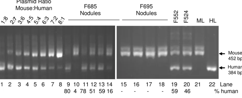 Figure 1Determination of the relative amount of human and mouse SCS-alpha genessected chimeric livers (F685, F695, F552, F524) was amplified by PCR with primers specific for SCS-Determination of the relative amount of human and mouse SCS-alpha genes