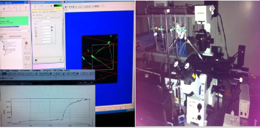 Figure 1. Single sperm was imaging by using confocol laser microscope and perfusion apparatus