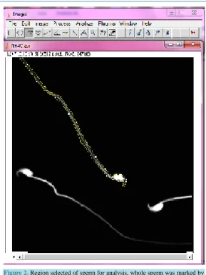 Figure 2. Region selected of sperm for analysis, whole sperm was marked by ROIs by using image J software