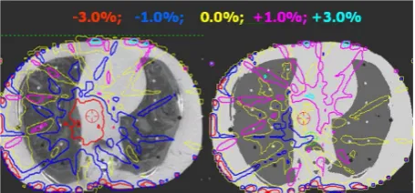 Figure 3. (a) The percent dose-difference of an SBRT plan computed on FBCT using FBCT-DF and on CBCT using FBCT-DF is overlayed on an axial plane from the CBCT image of a humanoid thorax section phantom; (b) The percent dose-dif- ference between SBRT plans