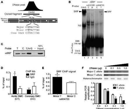 Figure 3. The minor T allele at rs604723 promotes SRF binding. (A) Schematic of sequence conservation at the center of the DHS2 region and of CArG homology at the rs604723 SNP