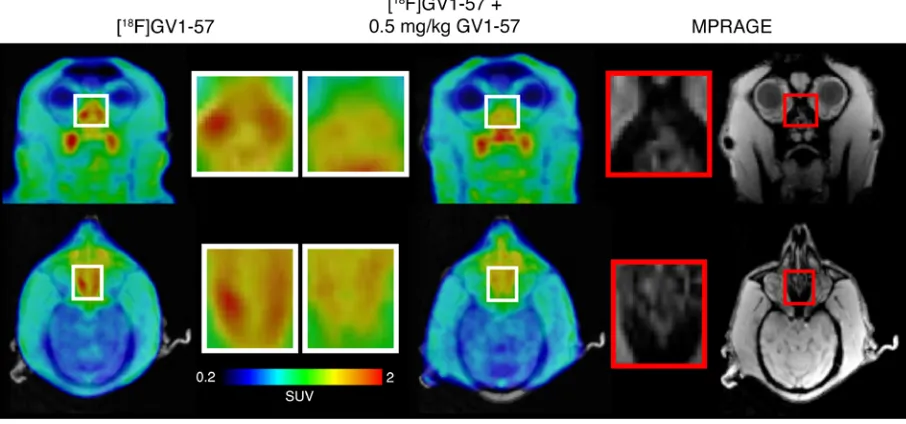 Figure 6. [18F]GV1-57 exhibits saturable nasal epithelium uptake in a rhesus macaque. Left: Coronal and axial [18F]GV1-57 PET images (SUV, NIH+white, 16–40 minutes) at the location of the superior nasal epithelium following administration of [18F]GV1-57 (4