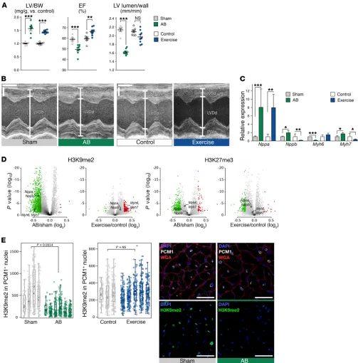 Figure 1. H3K9me2 is decreased in CMs upon AB in rats. (ChIP-seq. Red and green dots represent regions enriched and depleted upon hypertrophy (FDR <10%; >20% change)