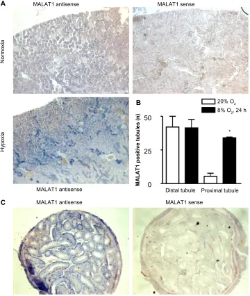 Figure 4 in situ expression of the lncrna MalaT1 in vivo. Mice were exposed to normoxia or hypoxia (8% O2) for 24 hours.Notes: in situ hybridization was performed with digoxigenin-labeled antisense or sense probes followed by detection with alkaline phosph