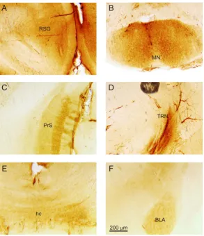 Figure 5. Expression of mGluR2 in other regions of the mouse brain. (A) Labeling in the retrosplenial gyrus (RSG), higher magnification image from Figure 1(Biii); (B) Labeling in the mammillary nuclei (MN), higher magnification image from Figure 1(Avi); (C