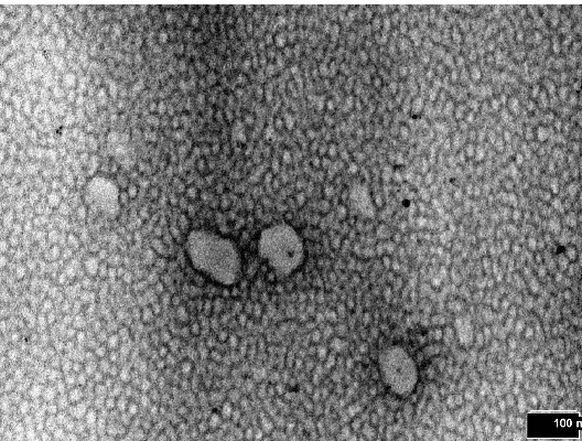 Figure 13 is a transmission electron microscopy (TEM) image of a PS-PAESO-PS sample. The image shows a semi-ordered structure where the black islands are the styrene (hard) blocks and the lighter regions are the AESO (soft) blocks