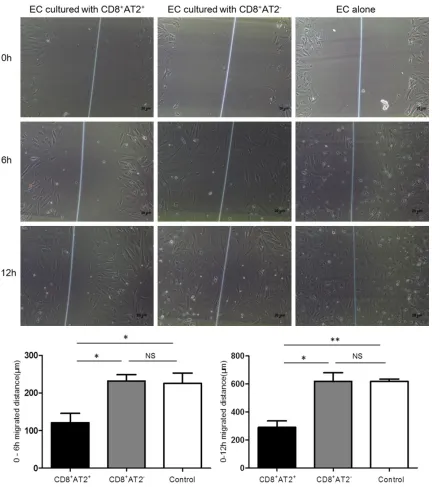 Figure 5. CD8+AT2+ lymphocytes inhibited ECs migration. There was significant difference in migration distance between ECs cocultured with CD8+AT2+ lymphocytes and CD8+AT2- lymphocytes or ECs alone for 6 h and 12 h