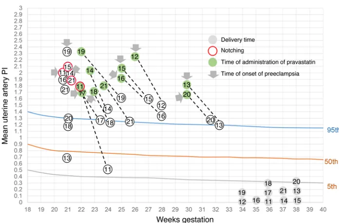 Figure 1. Mean uterine artery PI versus gestational age in the general population ment (gray arrows), PI values decreased