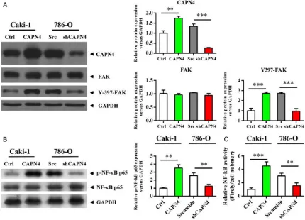 Figure 2. Capn4 activates FAK and NF-κB signaling pathways in RCC cells. A. Western blot analysis revealed that the phosphorylation level of FAK is up-regulated in the Caki1-Capn4 group or down-regulated in the 780-O-shCapn4 group compared to the respectiv