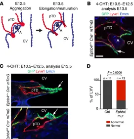 Figure 6. Early embryonic deletion of Ephb4embryo for indicated proteins. GFP shows efficient recombination in the LVV that extends to the lumen of the cardinal vein (arrow)