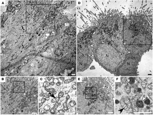 Figure 2. Ultrastructure of mitochondria in asthma airway epithelium. Ultrastructural analyses of bronchial epithelium from control (A–C) and asthma (D–F)