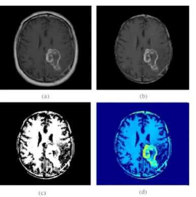 Fig-3: FCM algorithm input and output images after clustering [14]. 