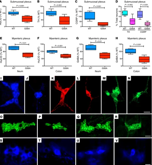 Figure 1. Numbers of total and late-born enteric neurons are lower in SERT Ala56 than in WT mice