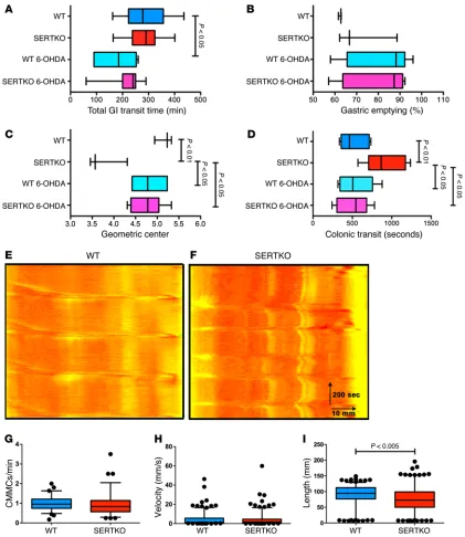 Figure 5. Sympathetic hyperactivity slows intestinal motility in SERTKO mice. Sympathetic hyperactivity slowed intestinal motility in SERTKO mice  (n = 6–9/group for in vivo motility, 2 trials, and 12/group for peristalsis)