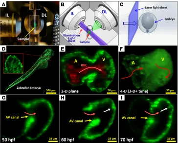 Figure 1. Fluorescent light sheets to image cardiac morphogenesis. (A) The sample is placed at the orthogo-nal intersection between the illumination lens (IL) and the detection lens (DL) in the SPIM system