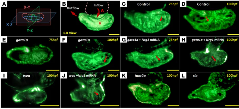 Figure 2. The dynamics of 3D cardiac architecture in response to genetic manipulations of the Tg(cmlc:gfp)beculation was absent in the tnnt2a 100 hpf