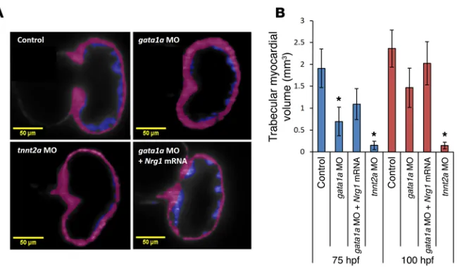 Figure 7. 3D quantification of myocardium from the trabecular ridges.100 hpf, respectively